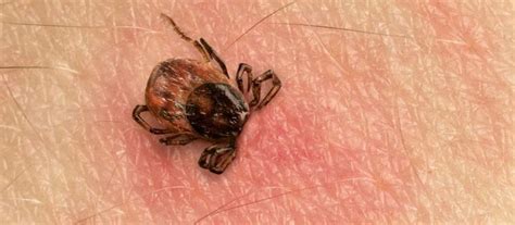 Arrow termite & pest control is the premier baton rouge pest control and termite control service. What to do When Ticks Infest Your Home: Pointe Pest Control