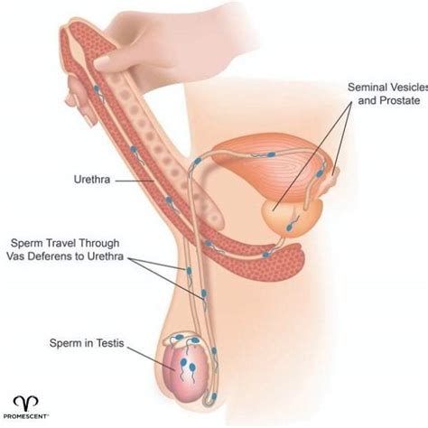 The Squeeze Technique: Step by Step Guide (With Images ...