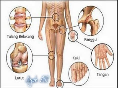 Check spelling or type a new query. Ayah_Alif: Asam Urat Dan Solusinya