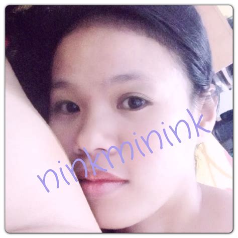  review  รีวิว ทำจมูกสดๆร้อนๆมา 1 สัปดาห์ + วิธีดูแลแบบขี้เกียจๆ. อยากเสริมจมูกที่หมอบุญถิ่นค่ะ - Pantip