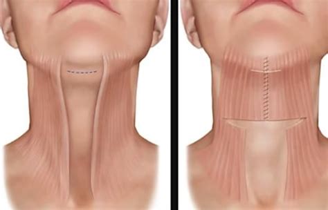 Short hairstyles to help hide jowls?. Short Hairstyles To Help Hide Jowls? - 10 Women S ...