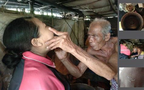 Gunakan berus gigi berbulu lembut untuk mengurangkan kerengsaan pada dentin dan saraf pulpa. Gambar Orang Yg Lagi Sakit Gigi