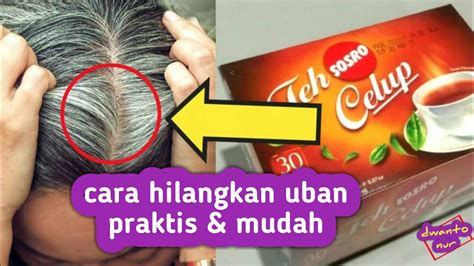 Cara mengatasi UBAN agar tidak tumbuh lagi - YouTube