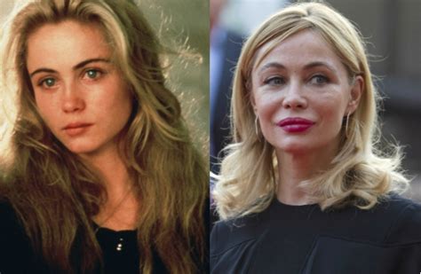 Emmanuelle béart (born 14 august 1963) is a french film actress, who has appeared in over 60 film and television productions since 1972. 14 ratés de la chirurgie esthétique