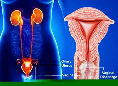 Cancer is a disease caused by the uncontrolled growth and proliferation of cells. Know the 7 Symptoms of Cervical Cancer | Cervical Cancer ...