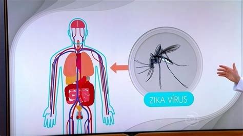 A tuberculose, pneumonias bacterianas e a ppj são responsáveis por mais de 80% das doenças graves do pulmão nas pvhs. Temperatura mais baixa aumenta o risco de pneumonia e ...