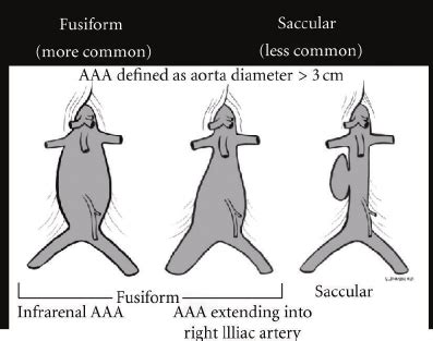 Part of the time will be creating the outline and/or drawings. The RUSH exam. Step 3: Evaluation of "the pipes ...