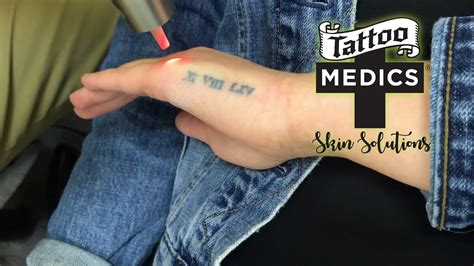 Tattoo removal unwanted tattoos can be removed gradually over a series of sessions using a laser. Laser Tattoo Removal Treatment at TattooMedics Skin ...