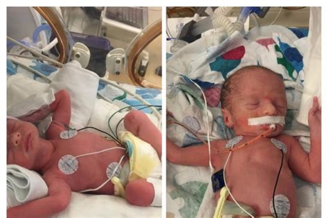 How many days after birth did you give your baby a bath. Oh! Mom who battled cancer while pregnant dies just a day ...