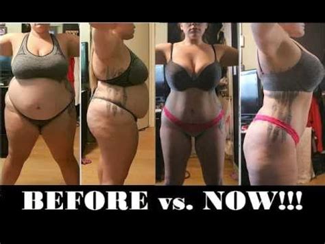 Increased levels of hormones can translate into fewer hairs lost during pregnancy. 1 Year Post VSG!!! | Before and Now Pics | Saggy Skin ...