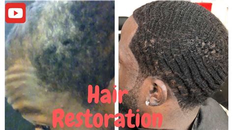 We use have something done to mean another person does a service for us. How I Grew My Hair Back//Hair Restoration//Natural hair ...