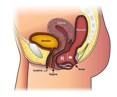 However, bee identification can be tricky, and many species have similar characteristics. Pimple between vagina surprise birthday threesome