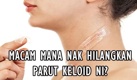 Penting juga untuk kita pastikan berus make up bersih. MACAM MANA NAK HILANGKAN PARUT KELOID NI? - BLOG MUMMY IDA