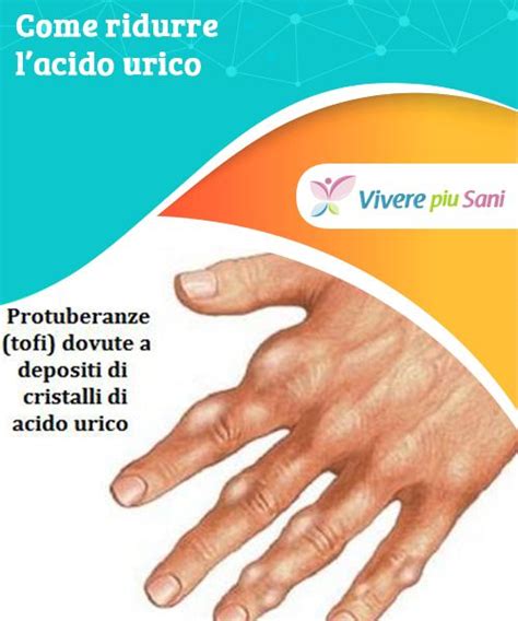 Oltre alla frutta anche la verdura non deve mai mancare nella dieta di chi soffre di uricemia o gotta. Pin su Buone abitudini