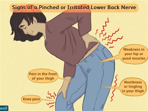 And then if you go to the gym for a workout after sitting at the desk all day and you don't stretch out and strengthen your hip flexors, you can compound that. Muscles In The Lower Back And Hip Area - Low Back Pain ...