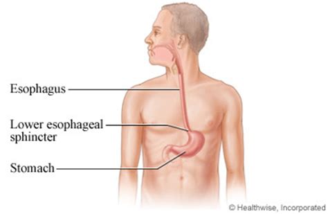 The esophagus can contract or expand to allow for the passage of food. Esophageal Spasm: Care Instructions