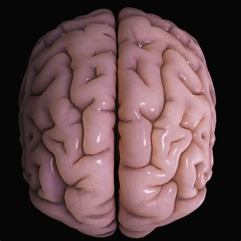 Acute transverse myelitis (atm) is an inflammatory condition affecting both halves of the spinal cord and associated with rapidly progressive motor, sensory, and autonomic dysfunction. Paraparesis : Important Points - Medical Notes ...