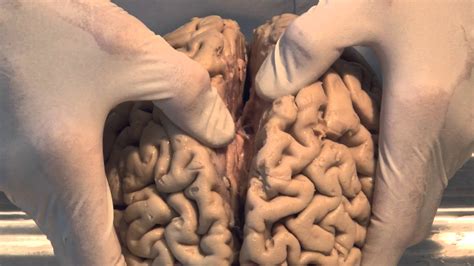Are you more creative than logical? Neuroanatomy Video Lab - Brain Dissections: Introduction ...