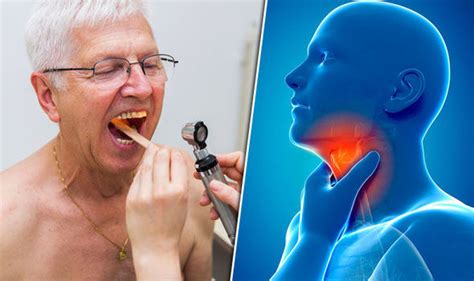 Symptoms of throat cancer can be characterized as a change in the voice, bad breath, a sore in the mouth that does not heal and continues to increase in size, constant pain an early indication of oral and throat cancer is one or more changes in the way the soft tissues of the mouth usually look or feel. Best supplements for arthritis: Omega-3 and turmeric could ...