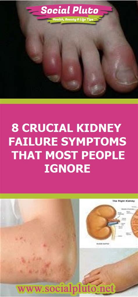No they don't your kidneys are situated in the back of your abdomen under your lower ribs, one on each each side of at what rate could a kidney stone grow if it is stuck inside the body? Located under the rib cage, kidneys are one of the vital ...