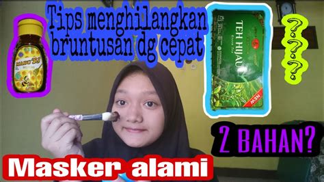 Selain itu, daki juga bisa terjadi dari keringat yang mengering dan mengeras dari kulit. CARA MENGHILANGKAN BRUNTUSAN DENGAN CEPAT!!!! - YouTube