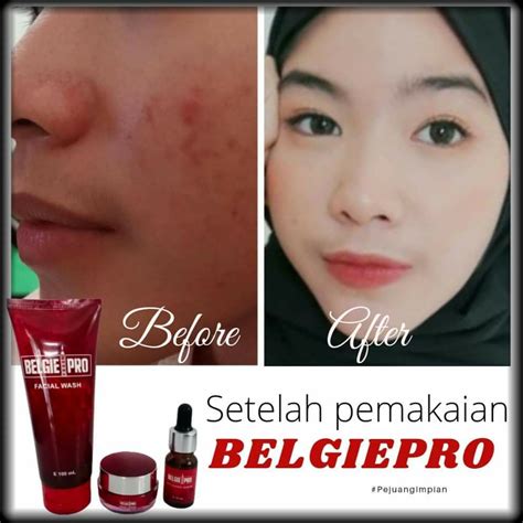 Serum perawatan wajah yang diformulasikan dengan kandungan propolis. Paket Belgie Pro Face Serum 5 Botol - Biritish Propolis ID