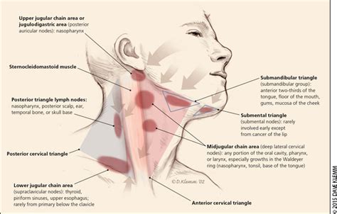 Posterior towards the back of the sternocleidomastoid muscle and anterior towards the trapezius muscle. Evaluation of Neck Masses in Adults - American Family ...