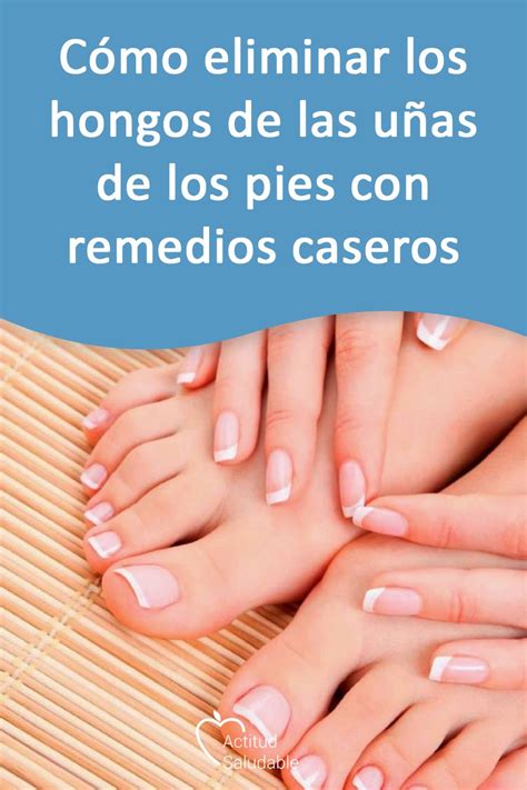 Ver más ideas sobre uñas, disenos de unas, pies bonitos mujer. Cómo eliminar los hongos de las uñas de los pies con ...