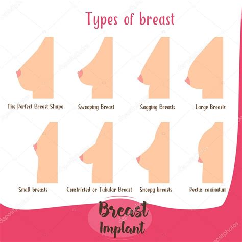 Here at brastop we are always spreading the word about how important it is to be wearing the luckily, we have put together this handy guide on the seven main breast shapes which will, in turn, help you to choose which type of bra is perfect for. The various forms of chest set . — Stock Vector ...