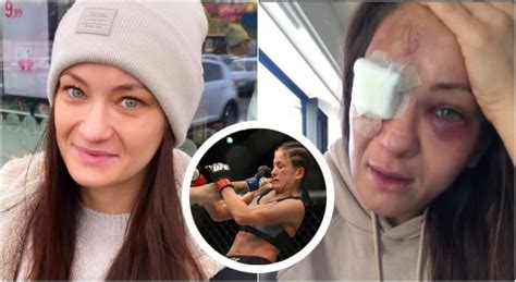 Karolina kowalkiewicz doznała groźnego urazu oka podczas ufc w auckland, ale może wrócić do polski na leczenie. Kowalkiewicz o kontuzji oka! Dramatyczne wyznanie ...