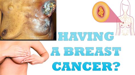 A biopsy will tell if it's cancer or not. Breast Cancer | How to know if you have Breast Cancer ...
