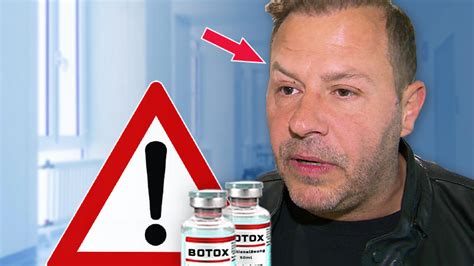 Meg ryan plastic surgery before and afte. Botox-Panne bei Willi Herren: Beauty-Doc legt seine ...