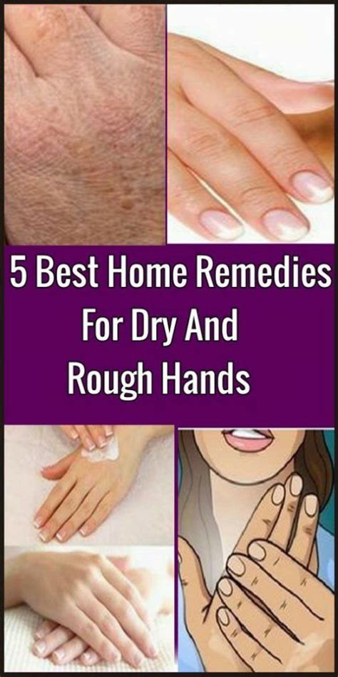 Can ayurvedic remedies help removing facial hairs due to pcos? 5 Best Home Remedies For Dry And Rough Hands - AZNDO ...