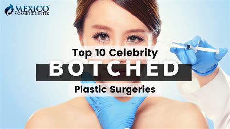 According to the american society for aesthetic plastic surgery (asaps), gynecomastia affects an estimated 40 to 60 percent of the male population. Plastic Surgery News Archives - Mexico Cosmetic Center