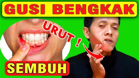 Cara bijak mencegah dan menangani gusi bengkak (abses gigi), ayo simak penjelasan berikut untuk menambah informasi mengenai abses gigi rasa sakit gusi bengkak bisa diatasi dengan hal ini gusi bengkak juga biasanya disertai dengan rasa sakit dan membuat anda merasa tidak nyaman. Pijat Sakit Gusi Bengkak - Cara Mengatasi Gusi Bengkak ...