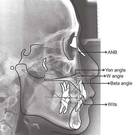 We did not find results for: (PDF) Assessment of Sagittal Discrepancies in Malaysian ...