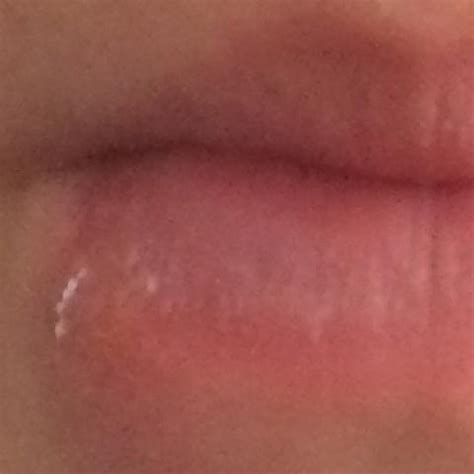 Vermische es in lotion oder kokosöl und benutze es wie eine bodylotion. Herpes schnell wegbekommen! (fieberblase, beseitigen)