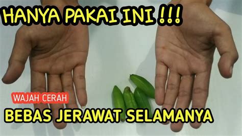 Cara menghilangkan jerawat untuk selamanya. Wajah cerah bebas jerawat selamanya...!!! | cara ...