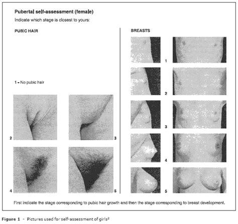 Around the same time as underarm hair: Jornal de Pediatria - Comparison between objective ...