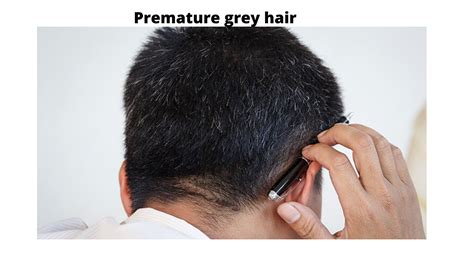 Greying hair is a part of your natural ageing process. Grey Hair? CAUSES & REMEDY Can hair greying be reversed?