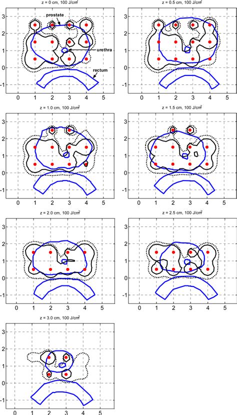 This is the reflected ceiling plan for this building. Comparison of 100% isodose lines of the reference clinical ...