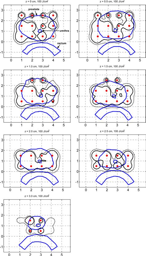 This is the reflected ceiling plan for this building. Comparison of 100% isodose lines of the reference clinical ...