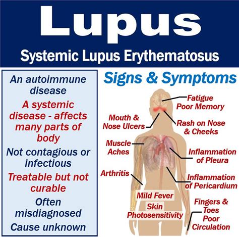 Doublet of lobo and wolf. What is lupus? Symptoms, causes, diagnosis, and treatment ...