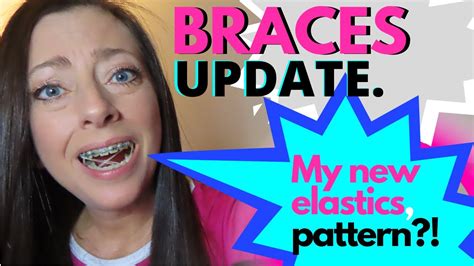 Next, dry your braces with a tissue. BRACES UPDATE | MY NEW ELASTICS PATTERN?! | HOW TO PUT ON ...