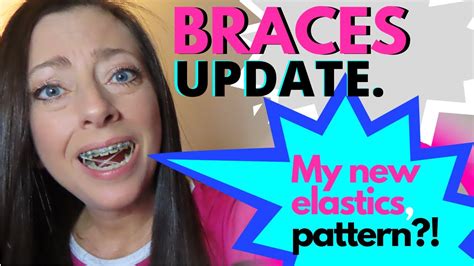 Each of these types is used for a specific purpose and a different place in the mouth. BRACES UPDATE | MY NEW ELASTICS PATTERN?! | HOW TO PUT ON ...