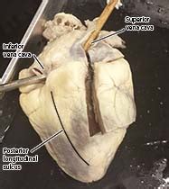 The coronary sinus drains the heart and receives most of the cardiac veins as tributaries. Heart Dissection Photos