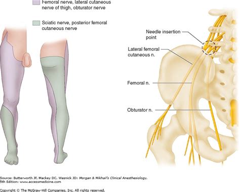 The responsibility for performing the nerve blocks shown on this site as part of any anesthesia regimen or pain management lies with the executing clinician. Dr. Amon Ferry on Twitter: "Combined Femoral-Sciatic Nerve ...