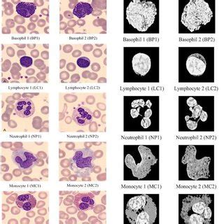 Leucocytes (also spelled leukocytes), or white blood cells (wbcs), are cells of the immune system defending the body against both infectious disease and foreign materials. Painted original white blood cells and segmented cells for ...