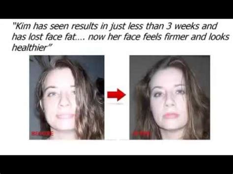 Your skin stretches to accommodate extra fat being stored on the body. HOW TO LOSE FACE WEIGHT and HOW TO Get RID of CHUBBY ...