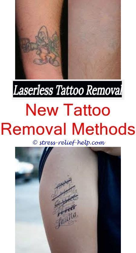 I've wanted a #magnolia tattoo for a really long time so i decided to get a. tattoo removal near me how much is laser tattoo removal ...
